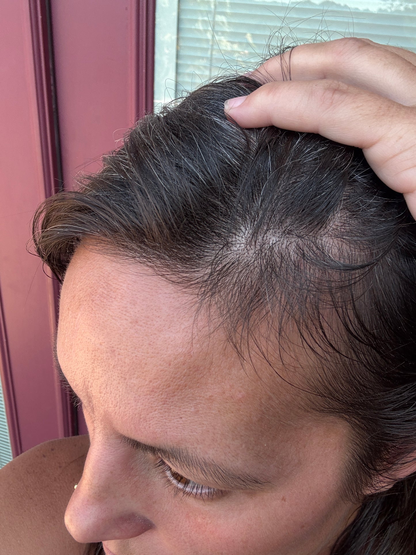 Anarchy Essentials Follicle Freak